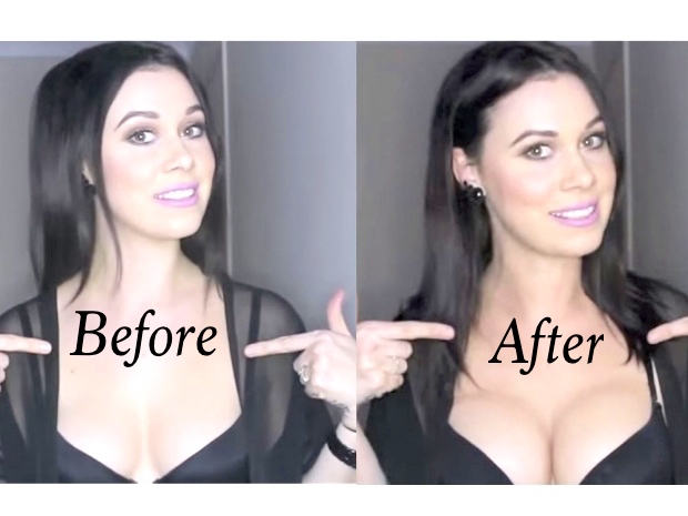 Cleavage enhancement contouring before and after